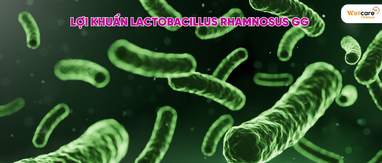 Colic Bebè-lợi khuẩn Lactobacillus Rhamnosus